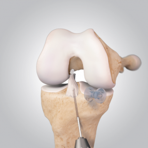 slide0033 image014 300x300