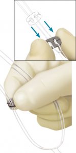 rekonsrtukcja acl06 149x300